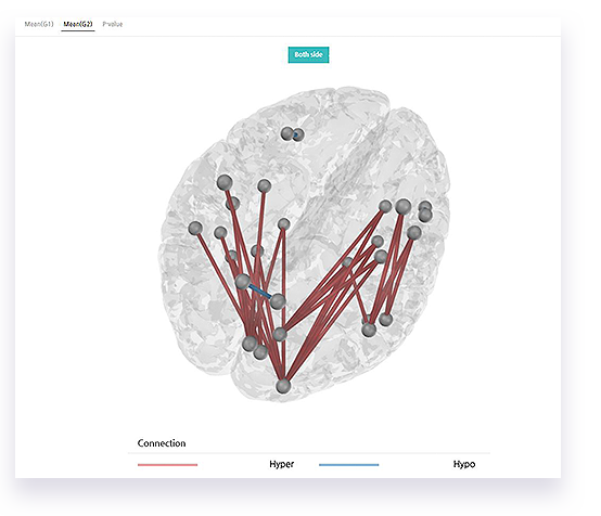 sub_isyncbrain_data-3Dconn1